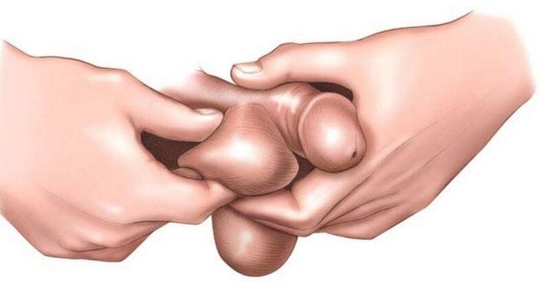 Why do men's balls itch